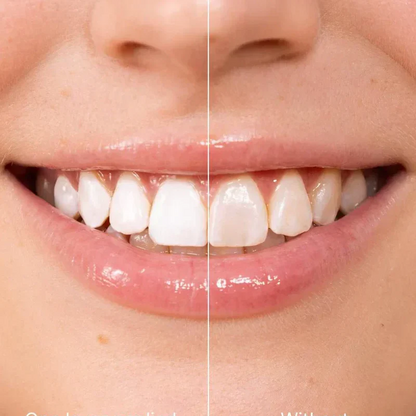 Express Teeth Whitening Gel