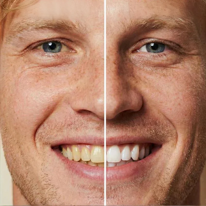 Express Teeth Whitening Gel