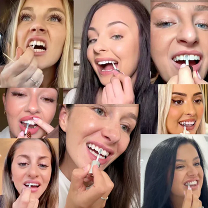 Express Teeth Whitening Gel